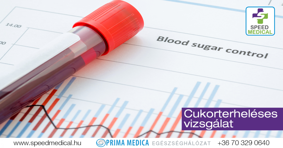 terheléses vércukor vizsgálat vélemények