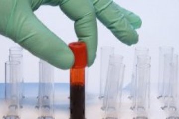 Tumormarkerek fontossága és értékelése