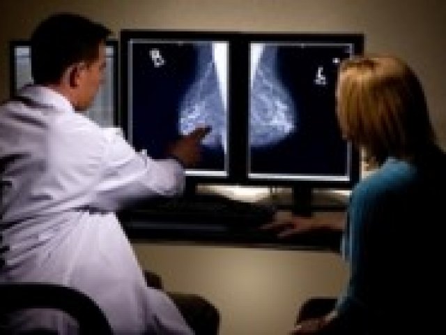 Emlőrák genetikai vizsgálat - BRCA1, BRCA2