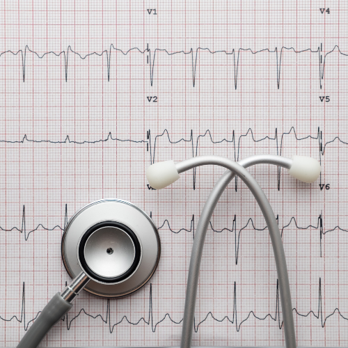 7 napos holter EKG
