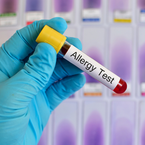 Multiplex allergia teszt