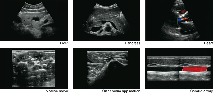 Prosztata ultrahang vizsgálat - Valeomed